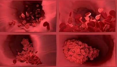 官方確認(rèn)阿斯利康疫苗或致血栓