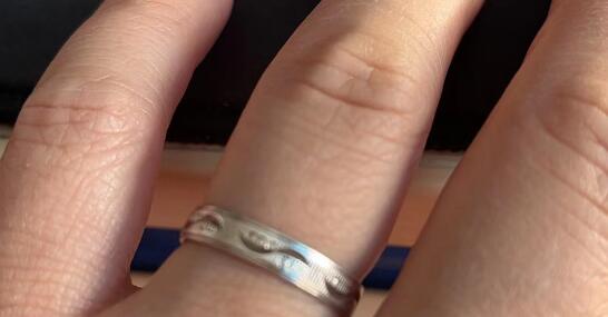 女子退燒后發(fā)現(xiàn)銀手鐲變黑了