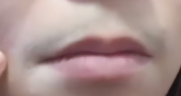 可能導致女性長胡子的原因