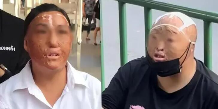 曼谷出現(xiàn)多名中國(guó)籍毀容乞討者